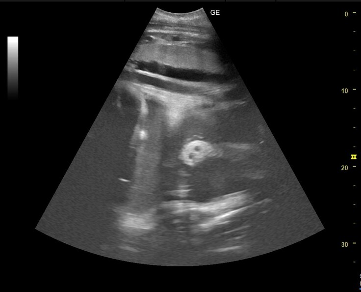 ゾウの胎児の鼻と思われるエコー画像