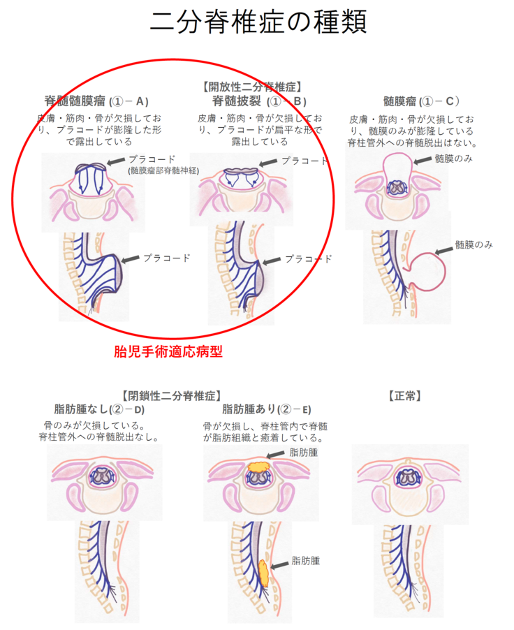 スクリーンショット 2025-03-31 20.07.25.png