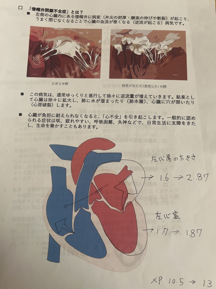 僧帽弁閉鎖不全症とは？